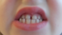 Mléčné zuby